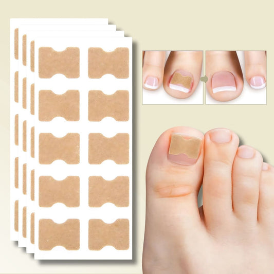 OngléFix – Correcteur d'ongles incarnés | Soulagement rapide & sans douleur
