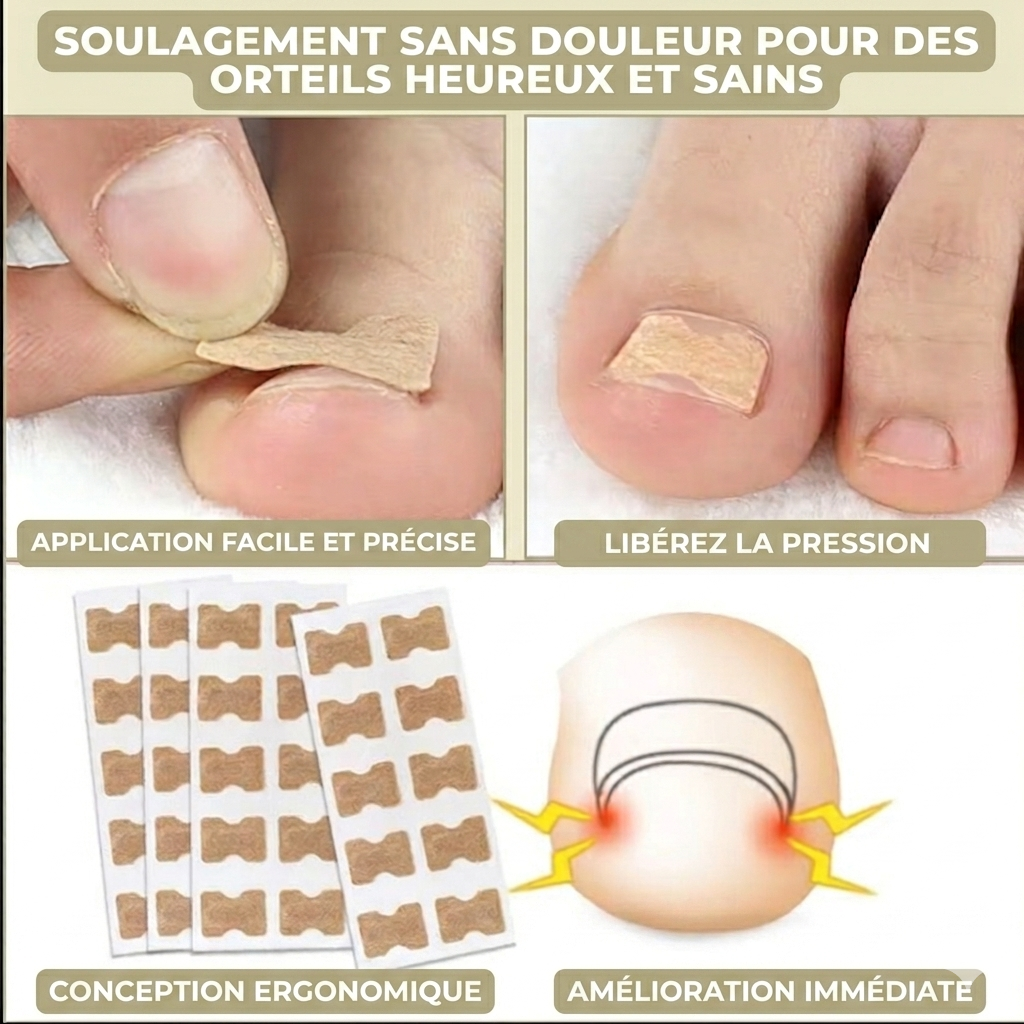 OngléFix – Correcteur d'ongles incarnés | Soulagement rapide & sans douleur